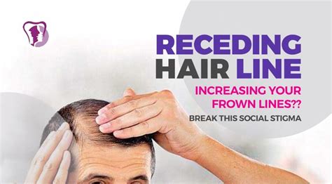 Receding Hairline, Increasing Your Frown Lines? Break This Social ...