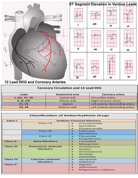 12 Lead Ecg Cheat Sheet Sheet | Images and Photos finder