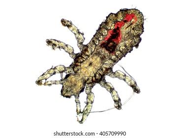 679 Body Louse Images, Stock Photos & Vectors | Shutterstock