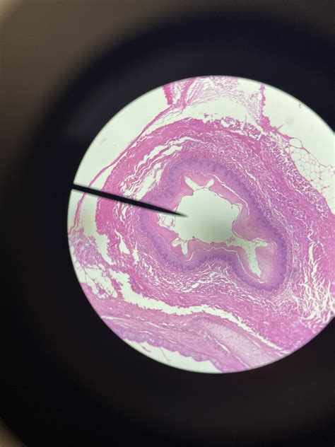 esophagus Diagram | Quizlet