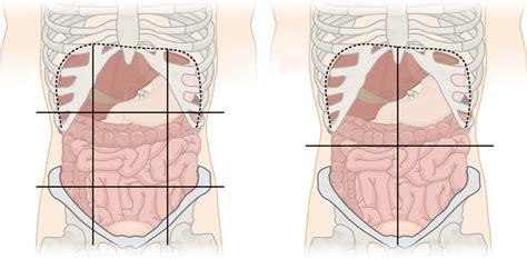 Quadrants and regions of abdomen - Wikipedia