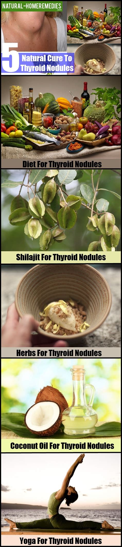 5 Natural Cure For Thyroid Nodules - Natural Treatment For Thyroid ...