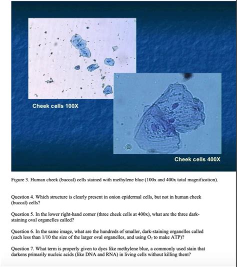 Solved Cheek cells 100X Cheek cells 400X Figure 3. Human | Chegg.com