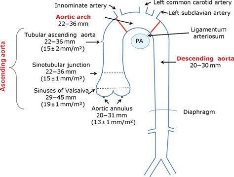 Aortic Root