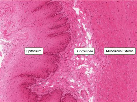 Upper Esophagus Histology