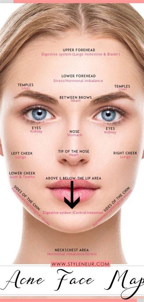 acne chart reasons ~ #acne #chart #reasons | Forehead acne, Face ...