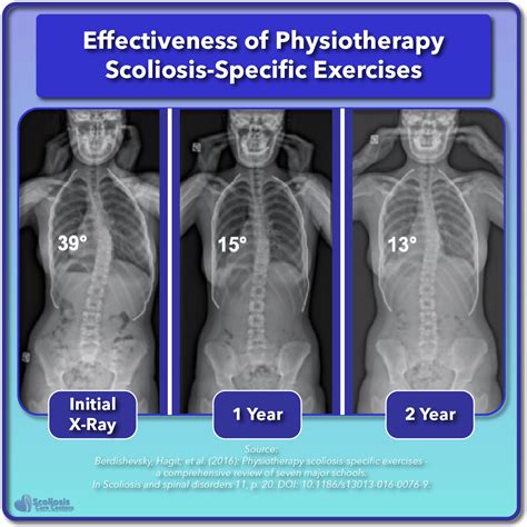 Scoliosis Treatment for Children and Teens - Scoliosis Care Centers