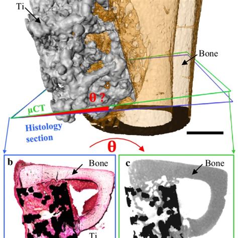 Bone ingrowth measured from 2D μCT slices and from edge to edge of a ...