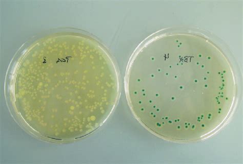 Aerobic mesophilic bacteria from a water sample that have formed ...