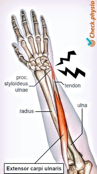 Extensor carpi ulnaris muscle - PT Master Guide