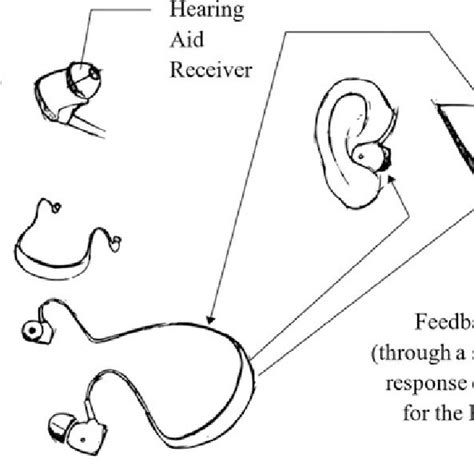 7 Proposed schematic diagram of the hearing aid | Download Scientific ...