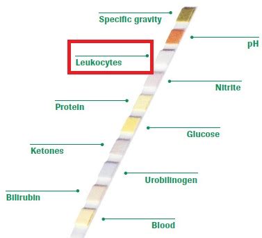 Leukocyte esterase (LE): Test, Trace and Treatment - Drugs Details