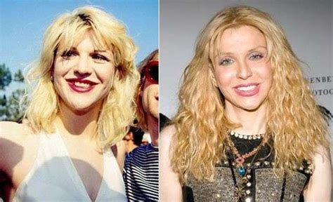 In Case You Missed: 20 Celebrities With Fake Teeth