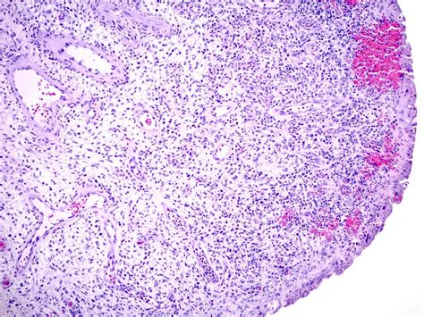 Endocervix Histology