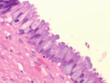 Normal Histology and Cytology of the Endocervix and Endometrium | Obgyn Key