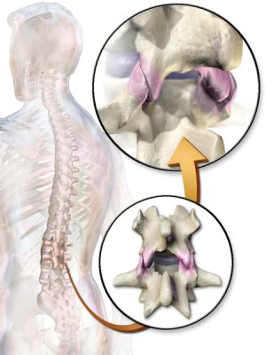 Facet Joints - Physiopedia