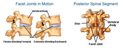 Portsmouth and Chichester Spine Surgeon | SpineInfo.co.uk | Facet Joint ...