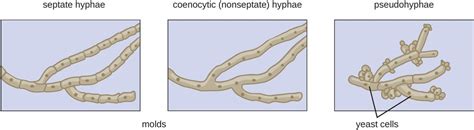 Mold: characteristics, types of hyphae and examples - Online Biology Notes