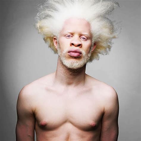 15+ Albino People Who’ll Mesmerize You With Their Otherworldly Beauty ...