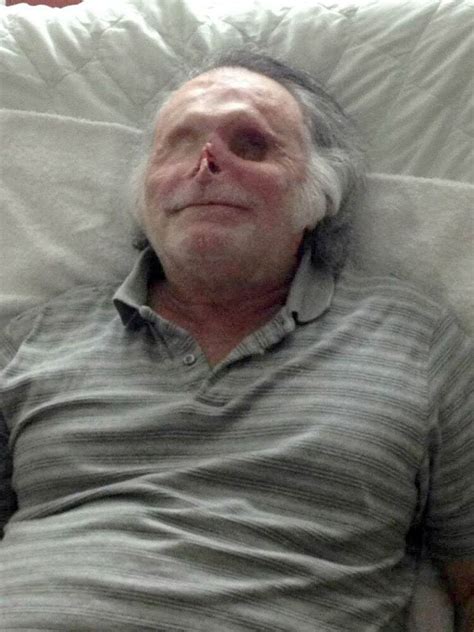 Ronald Poppo, Miami Cannibal Attack Victim ‘Living Happily' A Year ...