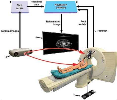 Diagram shows hardware and software components of computer-assisted ...