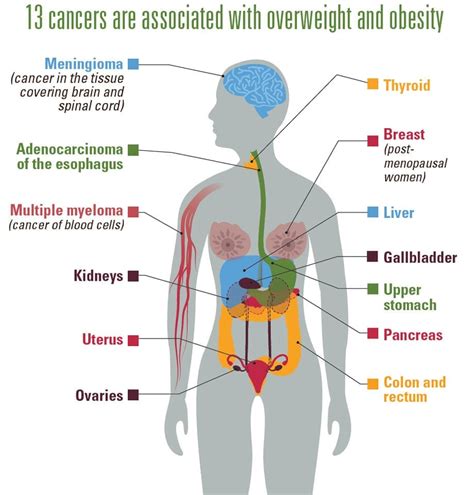 Obesity and Cancer | CDC