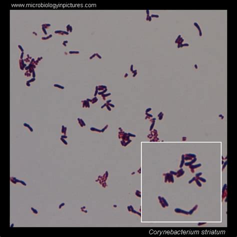 Corynebacterium striatum microscopy. Diphtheroids Gram-stained and cell ...