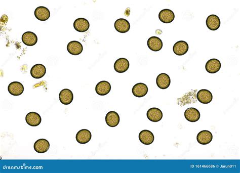 Eggs of Taenia or Tapeworm in Stool Stock Photo - Image of protozoa ...