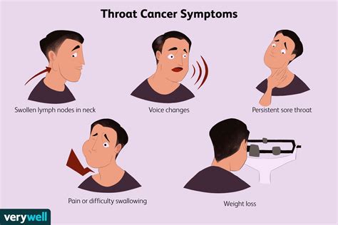 Swollen Lymph Nodes Neck Cancer Symptoms