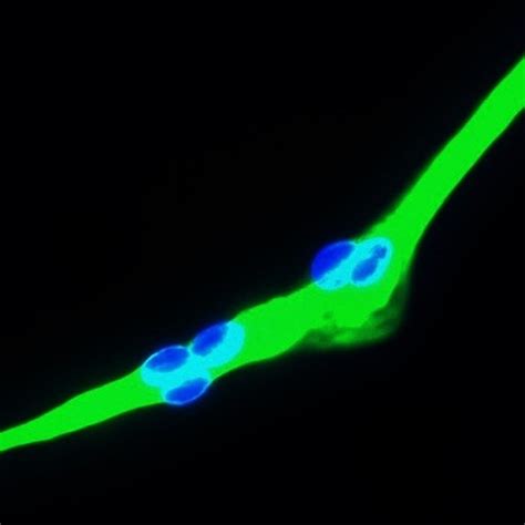 Human Skeletal Muscle Cells-adult – Cells Online