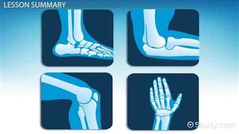 Hinge Joint Diagram For Kids