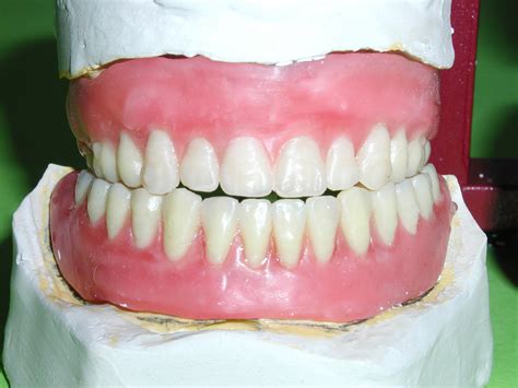 Free false teeth Stock Photo - FreeImages.com