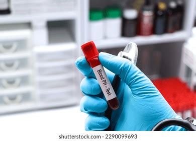 Blood Ph Test Look Abnormalities Blood Stock Photo 2290099693 ...