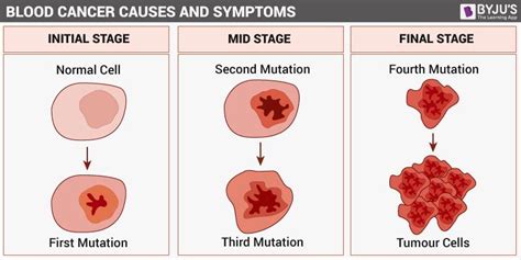 Blood Cancer- Types, Symptoms, Causes and its Treatment