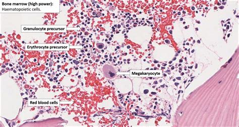 Bone Marrow – Normal Histology – NUS Pathweb :: NUS Pathweb