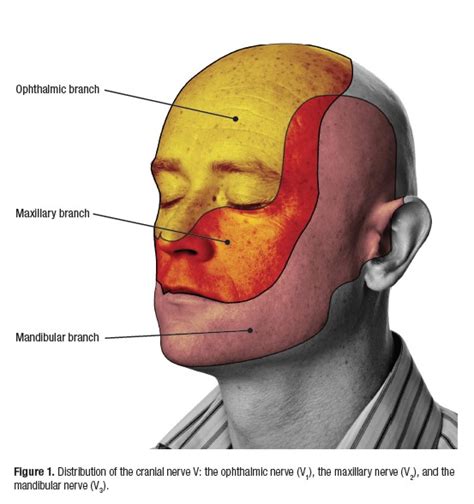 Signs and Symptoms of Trigeminal Neuralgia According to Experts ...