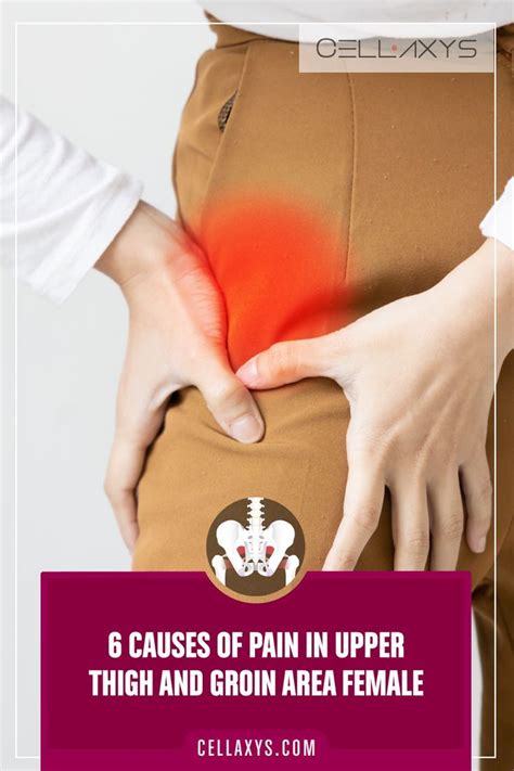 6 Causes of Pain in Upper Thigh and Groin Area Female | Leg pain relief ...