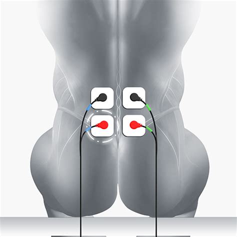 Tens Placement Chart Sciatica - Lower Back Muscles Electrode Pad Placement