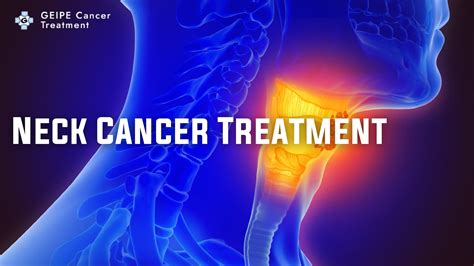 Understanding Neck Cancer: A Closer Look at Types, Causes, and Risk ...