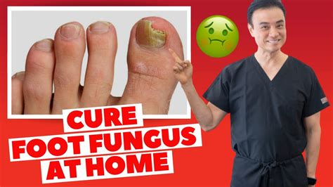 6 Effective HOME REMEDIES To CURE Toenail FUNGUS | Holistic Toenail ...