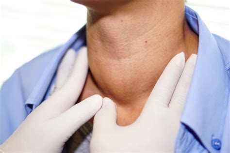 Are There Early Symptoms for Head and Neck Cancer? | Neck Cancer Symptoms