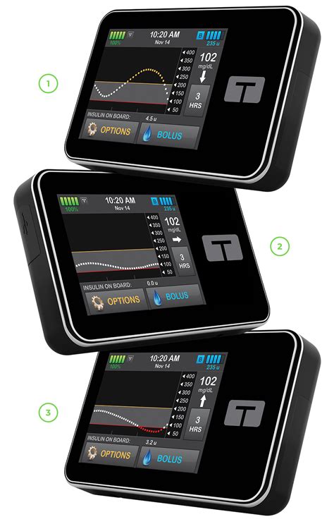 Benefits of CGM