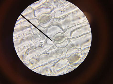 Lab science: L.16 EPIDERMIS CELLS