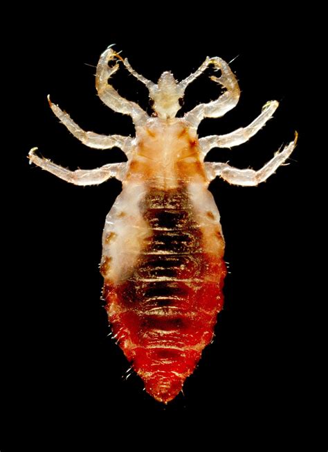 Body louse - Wikipedia