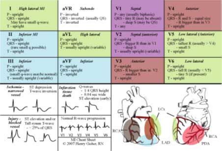 12 lead ecg interpretation made easy