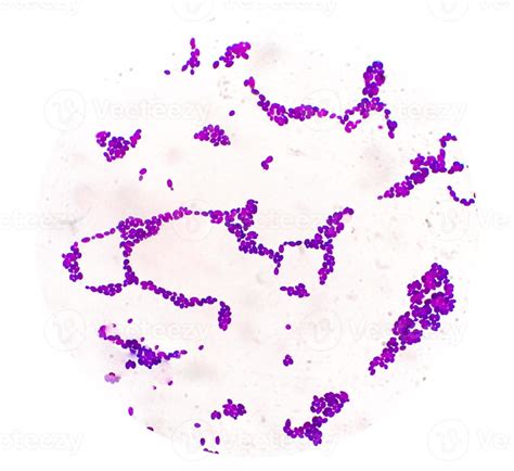 Candida Spp colony under microscopic view. Candida albicans. Fungal ...