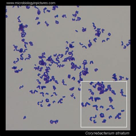 Corynebacterium microscopy. Corynebacterium Gram-stain and cell ...