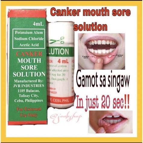 Canker Mouth Sore Solution Singaw Treatment | Lazada PH