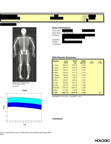 DXA Scan - Shape Up! Studies