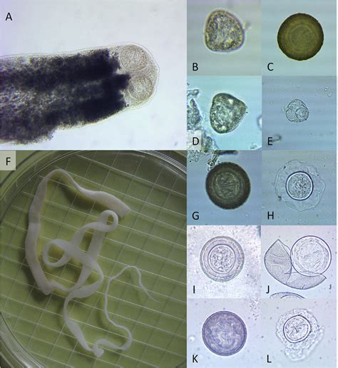 Tapeworm Eggs In Human Poop